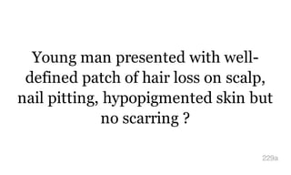 Young man presented with well-
defined patch of hair loss on scalp,
nail pitting, hypopigmented skin but
no scarring ?
229a
 