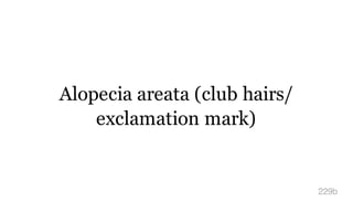 Alopecia areata (club hairs/
exclamation mark)
229b
 