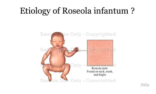 Etiology of Roseola infantum ?
242a
 