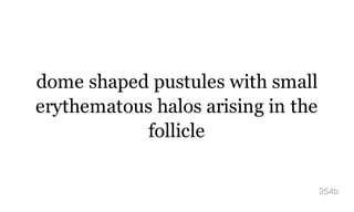 dome shaped pustules with small
erythematous halos arising in the
follicle
254b
 