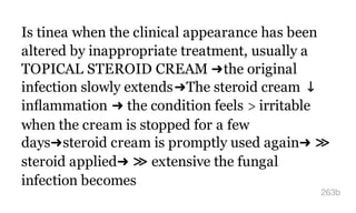 Is tinea when the clinical appearance has been
altered by inappropriate treatment, usually a
TOPICAL STEROID CREAM ➜the original
infection slowly extends➜The steroid cream ↓
inﬂammation ➜ the condition feels > irritable
when the cream is stopped for a few
days➜steroid cream is promptly used again➜ ≫
steroid applied➜ ≫ extensive the fungal
infection becomes
263b
 