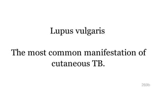 Lupus vulgaris
The most common manifestation of
cutaneous TB.
269b
 