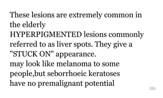 These lesions are extremely common in
the elderly
HYPERPIGMENTED lesions commonly
referred to as liver spots. They give a
"STUCK ON" appearance.
may look like melanoma to some
people,but seborrhoeic keratoses
have no premalignant potential
28b
 