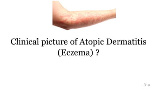 Clinical picture of Atopic Dermatitis
(Eczema) ?
31a
 