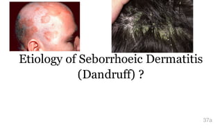 Etiology of Seborrhoeic Dermatitis
(Dandruff) ?
37a
 