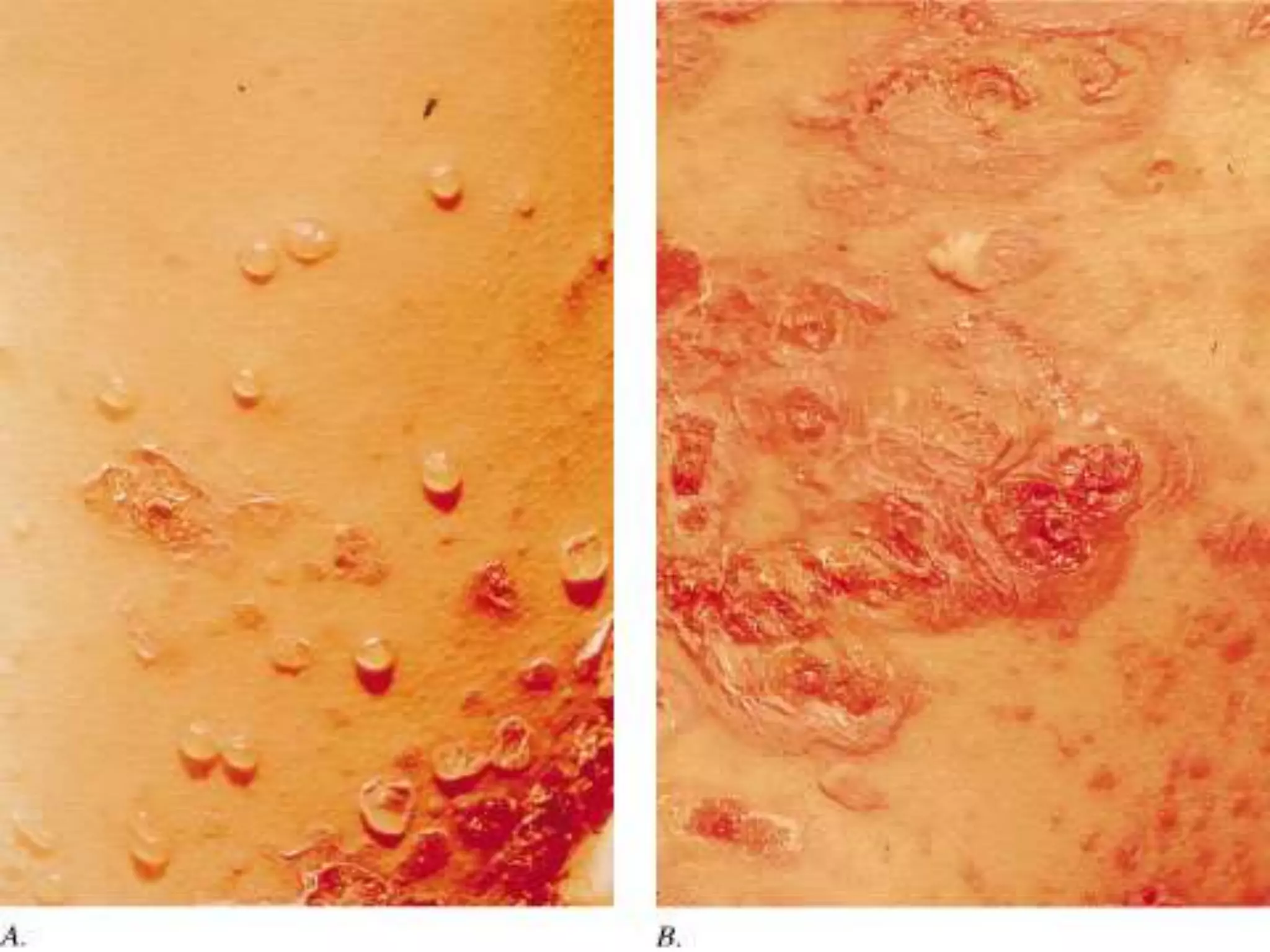 Dermatology lecture notes | PPTX
