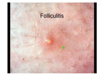 Dermatology lecture notes | PPTX