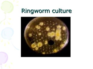 Ringworm cultureRingworm culture
 