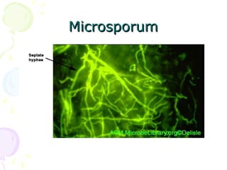 MicrosporumMicrosporum
 