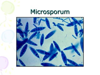 MicrosporumMicrosporum
 