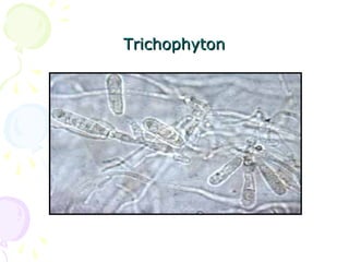 TrichophytonTrichophyton
 