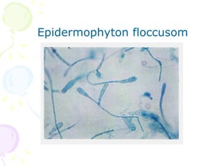 Epidermophyton floccusom
 