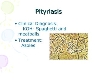 PityriasisPityriasis
• Clinical Diagnosis:
KOH- Spaghetti and
meatballs
• Treatment:
Azoles
 