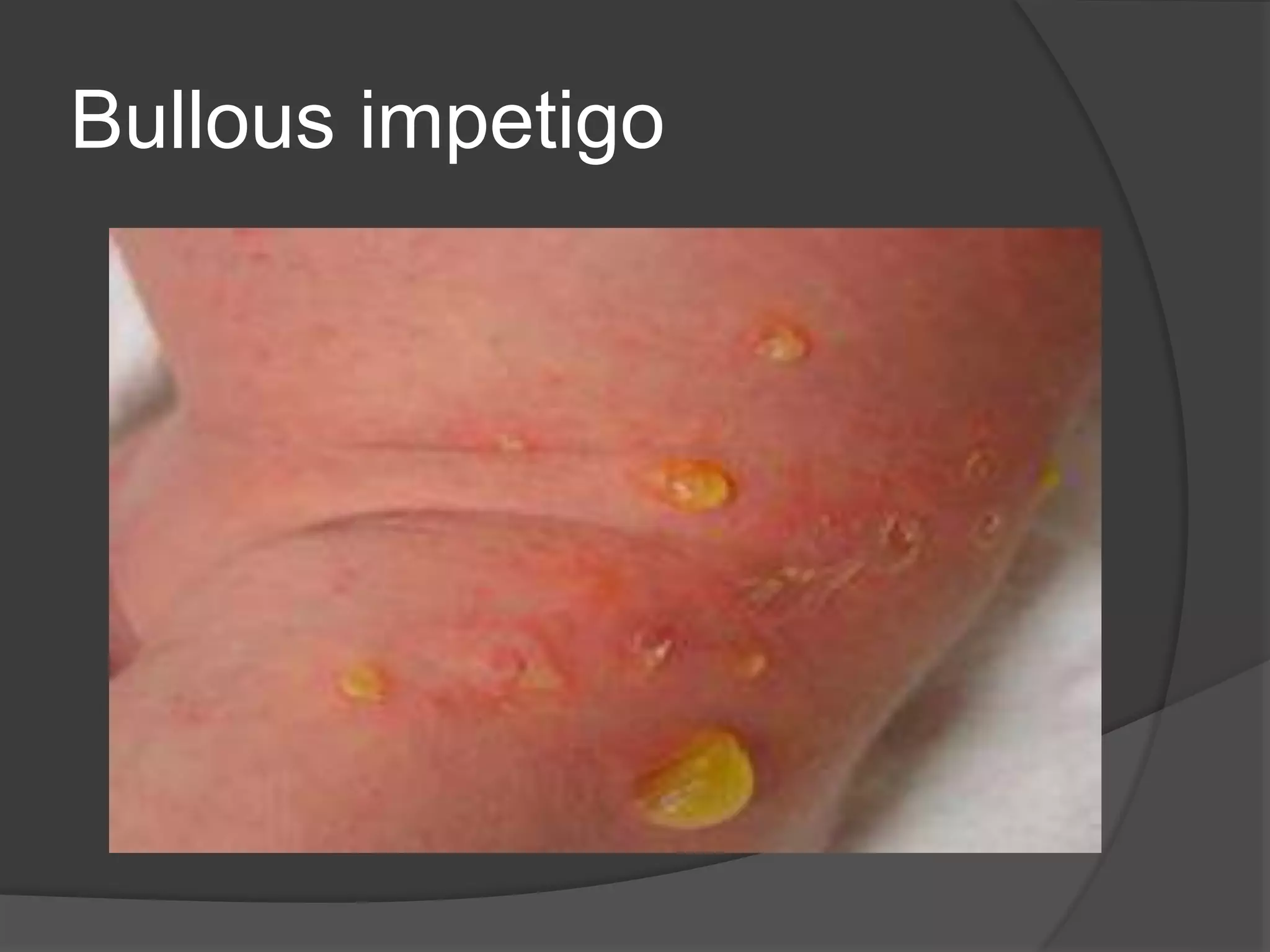 A total review of Dermatology by MS | PPTX