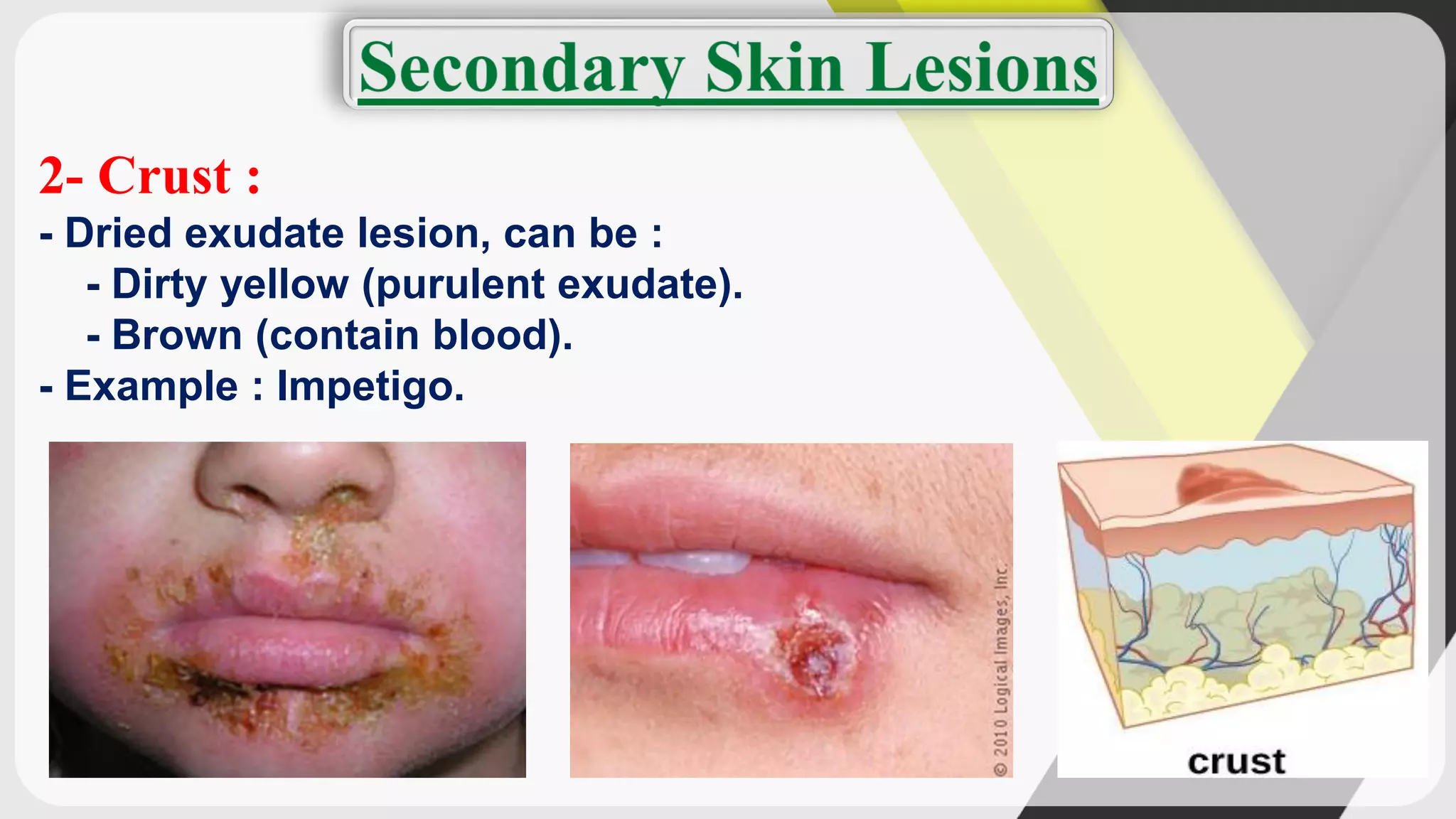 Dermatology (terminology of skin lesions) | PDF