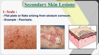 Outer Scale In Rash Scale Skin Lesion Causes