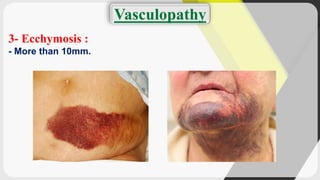 Dermatology (terminology of skin lesions) | PDF