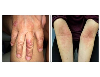DermatologyUW tables and charts.pdf