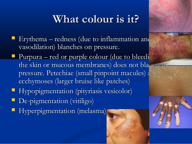 pinpoint red dots on skin cancer pinpoint red dots on skin cancer