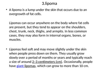 3.lipoma
• A lipoma is a lump under the skin that occurs due to an
overgrowth of fat cells.
Lipomas can occur anywhere on the body where fat cells
are present, but they tend to appear on the shoulders,
chest, trunk, neck, thighs, and armpits. In less common
cases, they may also form in internal organs, bones, or
muscles.
• Lipomas feel soft and may move slightly under the skin
when people press down on them. They usually grow
slowly over a period of months or years and typically reach
a size of around 2–3 centimeters (cm). Occasionally, people
have giant lipomas, which can grow to more than 10 cm.
 