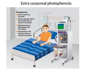 Extra corporeal photopheresis
 