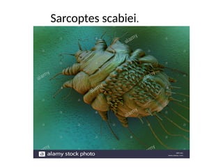 Sarcoptes scabiei.
 