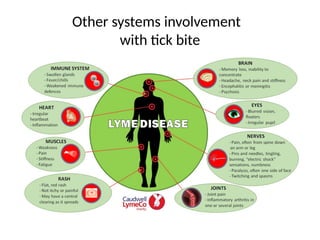 Other systems involvement
with tick bite
 