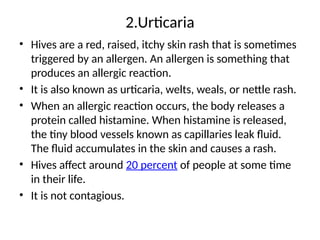 2.Urticaria
• Hives are a red, raised, itchy skin rash that is sometimes
triggered by an allergen. An allergen is something that
produces an allergic reaction.
• It is also known as urticaria, welts, weals, or nettle rash.
• When an allergic reaction occurs, the body releases a
protein called histamine. When histamine is released,
the tiny blood vessels known as capillaries leak fluid.
The fluid accumulates in the skin and causes a rash.
• Hives affect around 20 percent of people at some time
in their life.
• It is not contagious.
 