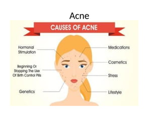 Acne
 