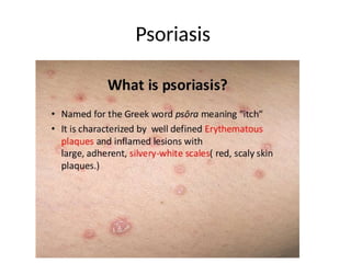 Psoriasis
 