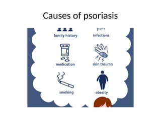 Causes of psoriasis
 
