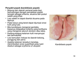 Dermatomikosis | PPT