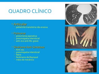 QUADRO CLÍNICO
• ArticularArticular
• poliartrite transitória não erosiva
• PulmonarPulmonar
• pneumonia aspirativa
• pneumopatia intersticial
• anti-Jo e anti-Ro: grave
• Síndrome Anti-SintetaseSíndrome Anti-Sintetase
• Anti-Jo1
• pneumopatia intersticial
• febre
• fenômeno de Raynaud
• mãos de mecânico
 