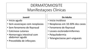 DERMATOMIOSITE
Manifestaçoes Clinicas
Juvenil
• Inicio agudo
• Sem associaçao com neoplasias
• Sem fenomeno de Raynaud
• Calcinose cutanea
• Hemorragia intestinal com
abdomen agudo
• Precedidda de infecçoes
Do Adulto
• Inicio insidioso
• Neoplasias em 10-30% dos casos
• Fenomeno de Raynaud
• Lesoes esclerodermiformes
• Poiquilodermia
• Telangiectasias peri-ungueais
 