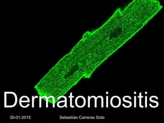 Dermatomiositis
30-01-2015 Sebastián Carreras Soto
 