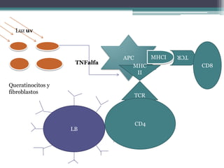 Luz uv



                              APC    MHCI
                                            TCR
                    TNFalfa
                                 MHC              CD8
                                  II

Queratinocitos y
fibroblastos
                                TCR




                                CD4
                   LB
 