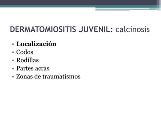 DERMATOMIOSITIS JUVENIL: calcinosis
•   Localización
•   Codos
•   Rodillas
•   Partes acras
•   Zonas de traumatismos
 