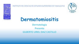 Dermatomiositis
Dermatologia
Presenta
GILBERTO URIEL DIAZ CASTILLO
INSTITUTODE CIENCIASDE ESTUDIOSSUPERIORES DE TAMAULIPAS
 