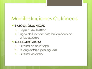 Manifestaciones Cutáneas
 PATOGNOMÓNICAS
1. Pápulas de Gottron
2. Signo de Gottron: eritema violáceo en
articulaciones
 CARACTERÍSTICAS
1. Eritema en heliotropo
2. Telangiectasia periungueal
3. Eritema violáceo
 