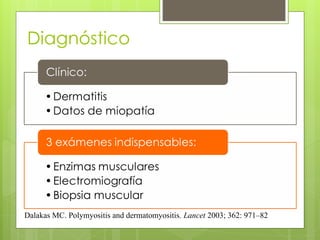 Diagnóstico
Dalakas MC. Polymyositis and dermatomyositis. Lancet 2003; 362: 971–82
 