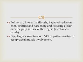 
 Pulmonary interstitial fibrosis, Raynaud’s phenom-
enon, arthritis and hardening and fissuring of skin
over the pulp surface of the fingers (mechanic’s
hands)
 Dysphagia is seen in about 50% of patients owing to
oesophageal muscle involvement.
 