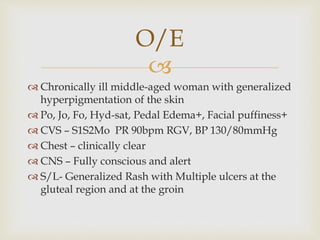 
 Chronically ill middle-aged woman with generalized
hyperpigmentation of the skin
 Po, Jo, Fo, Hyd-sat, Pedal Edema+, Facial puffiness+
 CVS – S1S2Mo PR 90bpm RGV, BP 130/80mmHg
 Chest – clinically clear
 CNS – Fully conscious and alert
 S/L- Generalized Rash with Multiple ulcers at the
gluteal region and at the groin
O/E
 