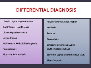 DIFFERENTIAL DIAGNOSIS
 Discoid Lupus Erythematosus
 GraftVersus Host Disease
 Lichen Myxedematosus
 Lichen Planus
 Multicentric Reticulohistiocytosis
 Parapsoriasis
 Pityriasis Rubra Pilaris
 Polymorphous Light Eruption
 Psoriasis
 Rosacea
 Sarcoidosis
 Subacute Cutaneous Lupus
Erythematosus (SCLE)
 Systemic Lupus Erythematosus (SLE)
 Tinea Corporis
 