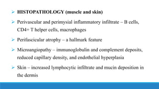 ➢ HISTOPATHOLOGY (muscle and skin)
➢ Perivascular and perimysial inflammatory infiltrate – B cells,
CD4+ T helper cells, macrophages
➢ Perifascicular atrophy – a hallmark feature
➢ Microangiopathy – immunoglobulin and complement deposits,
reduced capillary density, and endothelial hyperplasia
➢ Skin – increased lymphocytic infiltrate and mucin deposition in
the dermis
 
