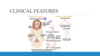 CLINICAL FEATURES
 