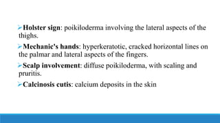 ➢Holster sign: poikiloderma involving the lateral aspects of the
thighs.
➢Mechanic's hands: hyperkeratotic, cracked horizontal lines on
the palmar and lateral aspects of the fingers.
➢Scalp involvement: diffuse poikiloderma, with scaling and
pruritis.
➢Calcinosis cutis: calcium deposits in the skin
 