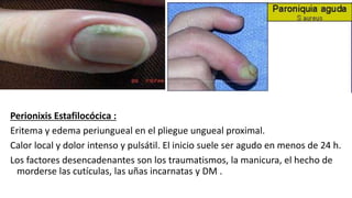 Perionixis Estafilocócica :
Eritema y edema periungueal en el pliegue ungueal proximal.
Calor local y dolor intenso y pulsátil. El inicio suele ser agudo en menos de 24 h.
Los factores desencadenantes son los traumatismos, la manicura, el hecho de
morderse las cutículas, las uñas incarnatas y DM .
 