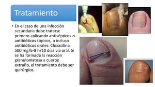 Tratamiento
• En el caso de una infección
secundaria debe tratarse
primero aplicando antisépticos o
antibióticos tópicos, o incluso
antibióticos orales: Cloxacilina
500 mg/6-8 h/10 días via oral. Si
se ha formado la reacción
granulomatosa a cuerpo
extraño, el tratamiento debe ser
quirúrgico.
 