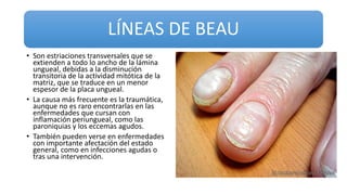 LÍNEAS DE BEAU
• Son estriaciones transversales que se
extienden a todo lo ancho de la lámina
ungueal, debidas a la disminución
transitoria de la actividad mitótica de la
matriz, que se traduce en un menor
espesor de la placa ungueal.
• La causa más frecuente es la traumática,
aunque no es raro encontrarlas en las
enfermedades que cursan con
inflamación periungueal, como las
paroniquias y los eccemas agudos.
• También pueden verse en enfermedades
con importante afectación del estado
general, como en infecciones agudas o
tras una intervención.
 
