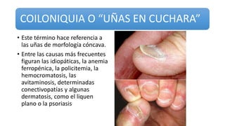 COILONIQUIA O “UÑAS EN CUCHARA”
• Este término hace referencia a
las uñas de morfología cóncava.
• Entre las causas más frecuentes
figuran las idiopáticas, la anemia
ferropénica, la policitemia, la
hemocromatosis, las
avitaminosis, determinadas
conectivopatías y algunas
dermatosis, como el liquen
plano o la psoriasis
 
